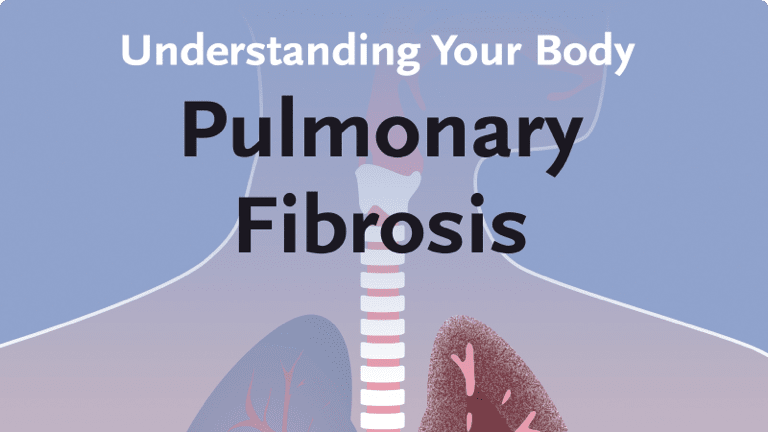 Pulmonary fibrosis pocket doktor